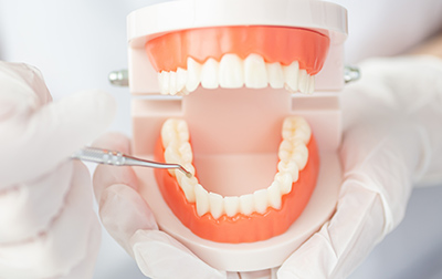 歯周ポケット検査