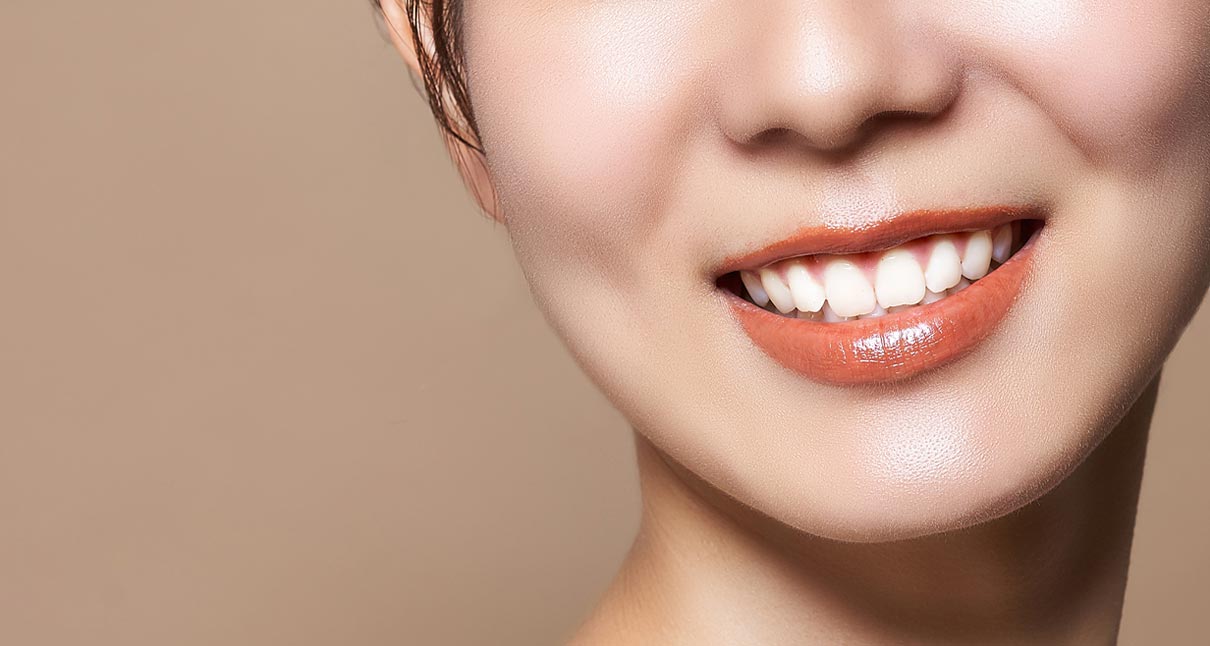 インプラントのメリット